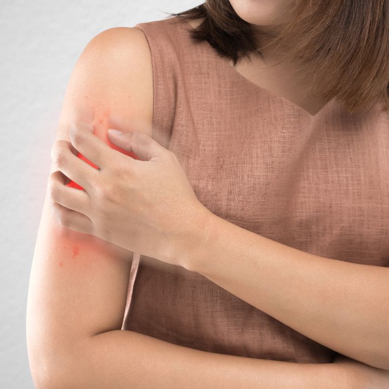 Nutrizionista.Bio Psoriasi metodo apollo