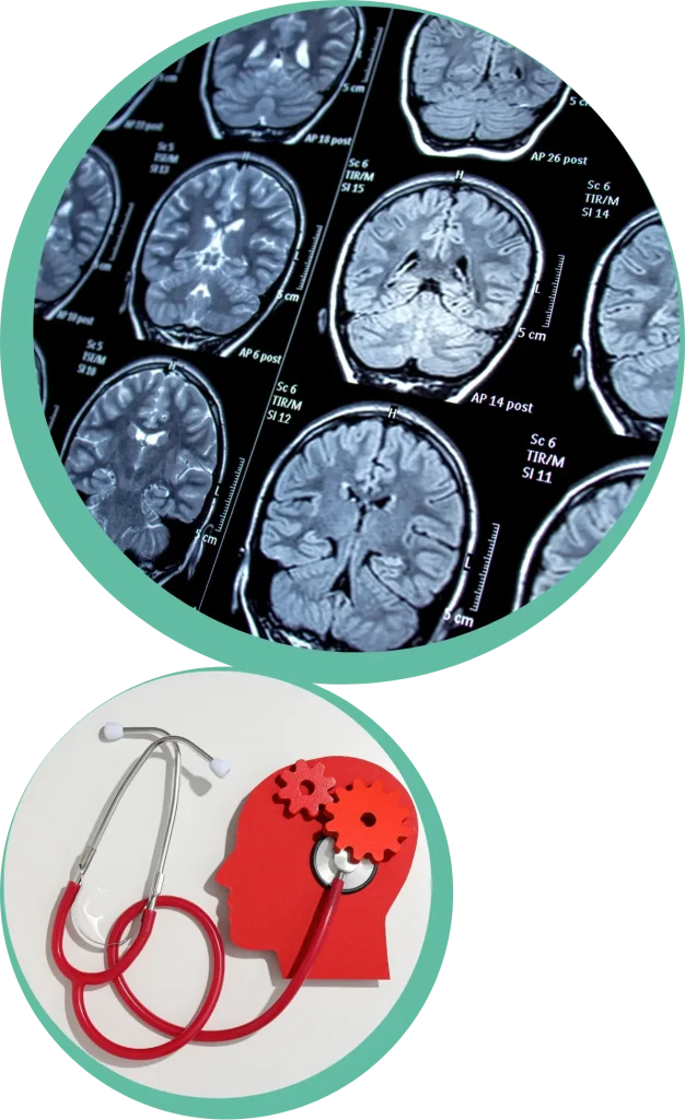 epilessia cose