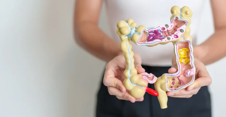 colon irritabile ibs