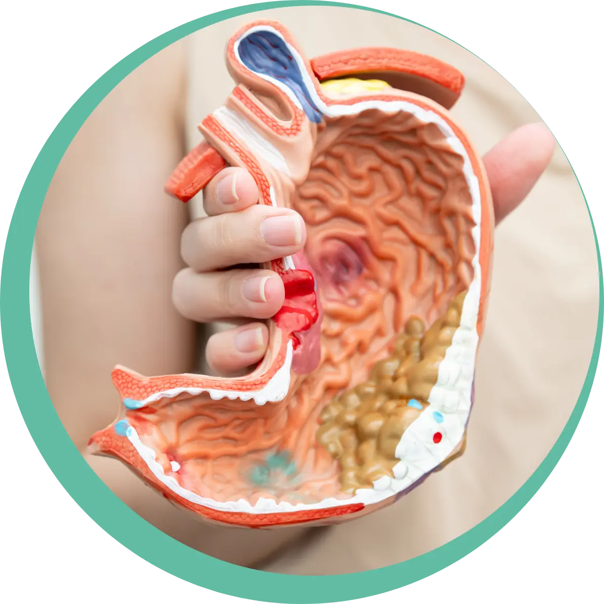 nutrizione e patologie disbiosi